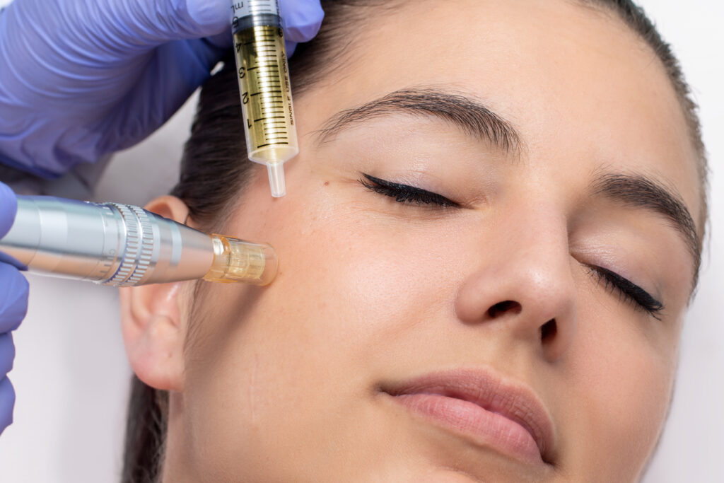 Microneedeling - Dermapen-mit höchst qualitativen Ampullen